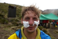 второй день на горе без кепки